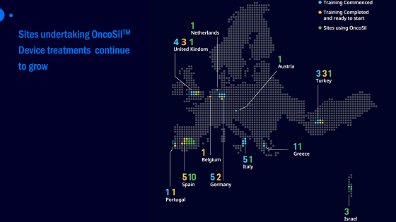【异动股】OncoSil Medical（ASX:OSL）胰腺癌治疗设备完成在西班牙的第30次治疗 