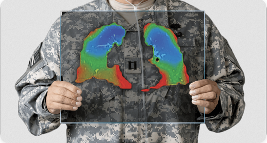 【异动股】4DMEDICAL (ASX:4DX) 肺部成像通气灌注产品CT:VQ获得美国FDA批准上市 股价暴涨36% 