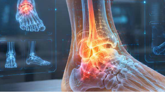  【异动股】CurveBeam AI（ASX：CVB）【仰卧位CT扫描骨密度评估技术获得美国FDA 510(k)许可